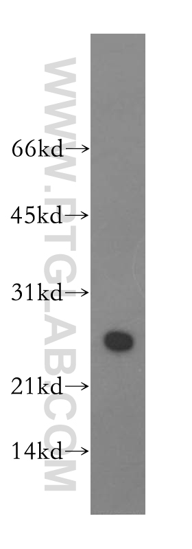 12929-2-AP;human brain tissue