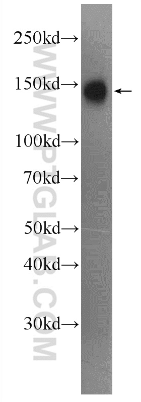 24705-1-AP;Jurkat cells