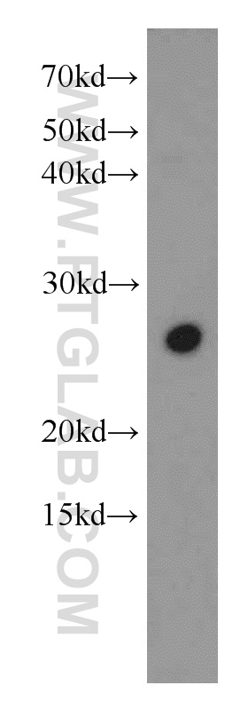 17926-1-AP;HEK-293 cell