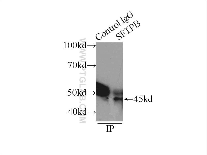 13664-1-AP;Y79 cells