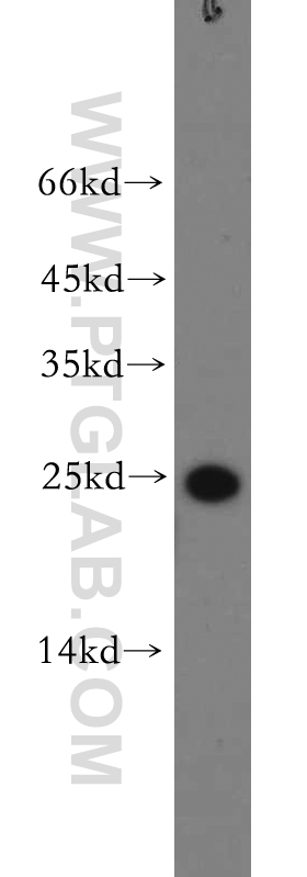 10774-1-AP;A549 cells