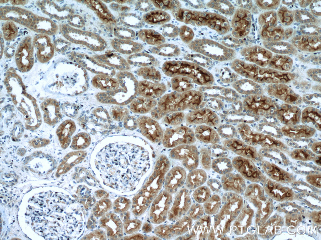 24654-1-AP;human kidney tissue