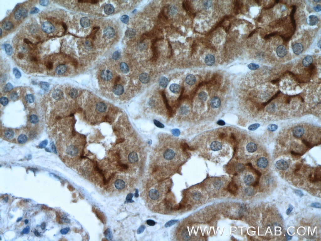 24654-1-AP;human kidney tissue