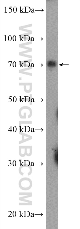 24654-1-AP;A549 cells