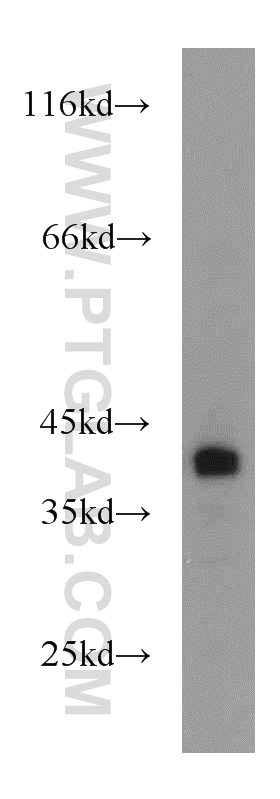 15422-1-AP;mouse kidney tissue