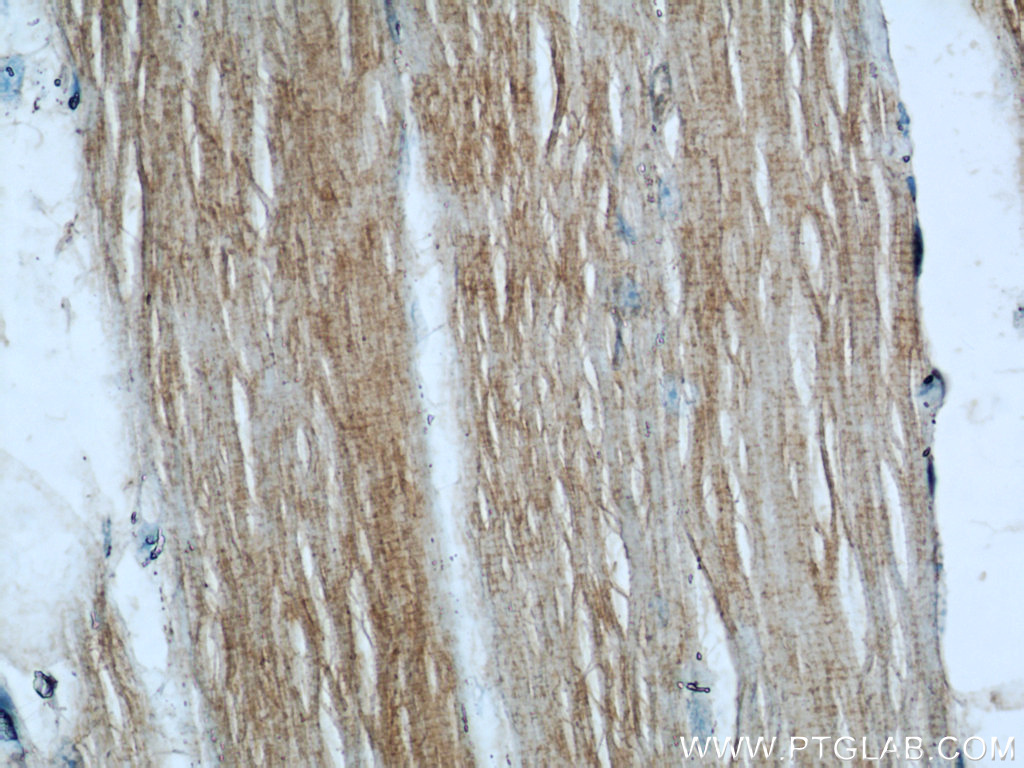 21909-1-AP;human skeletal muscle tissue