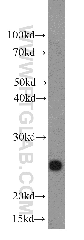 15168-1-AP;mouse kidney tissue