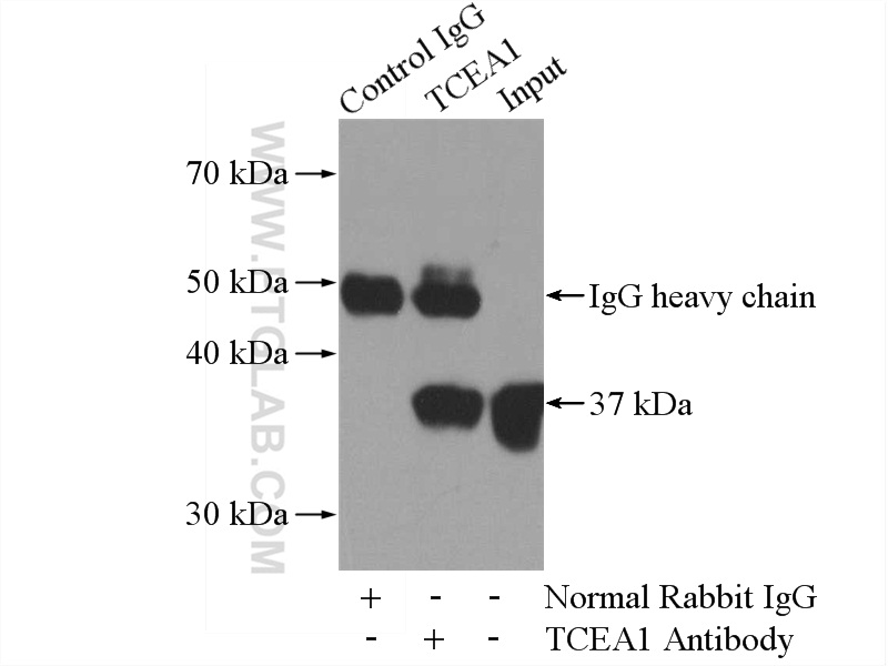 17825-1-AP;HeLa cells