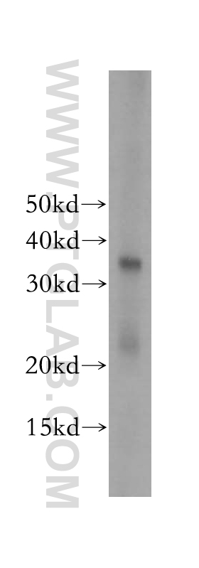 17825-1-AP;Sp2/0 cell