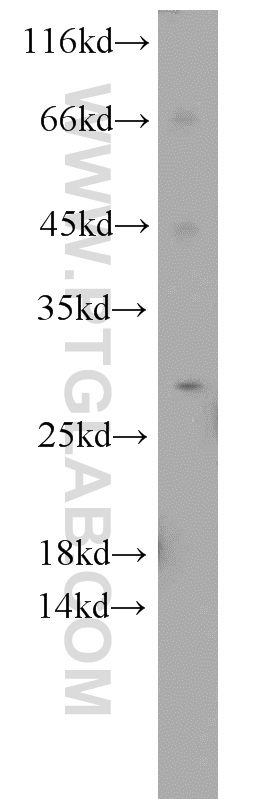 22432-1-AP;mouse brain tissue