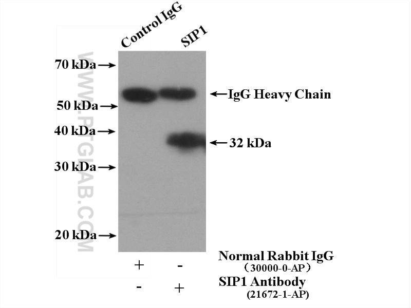 21672-1-AP;HepG2 cells