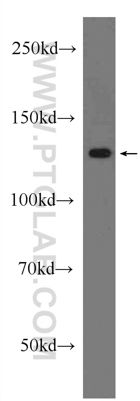 13161-1-AP;HeLa cells