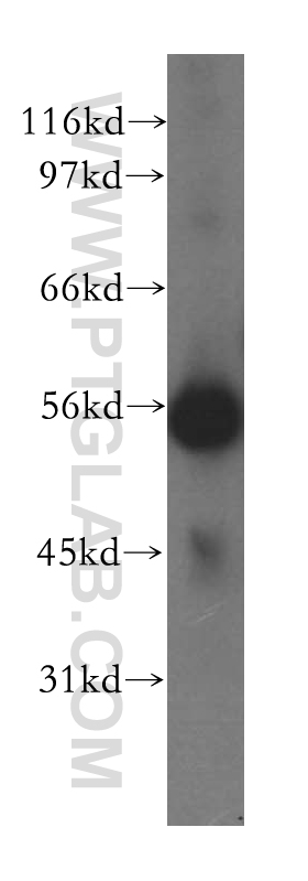 12926-1-AP;human liver tissue