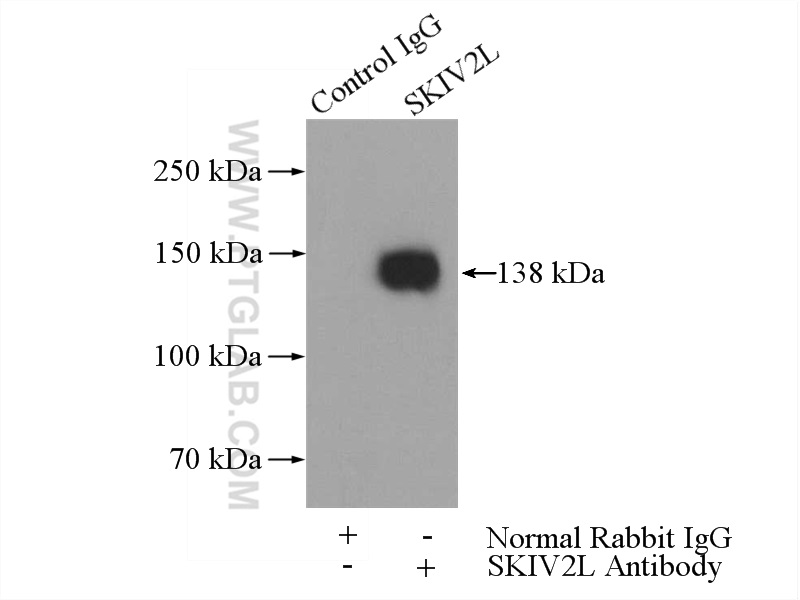 11462-1-AP;HepG2 cells