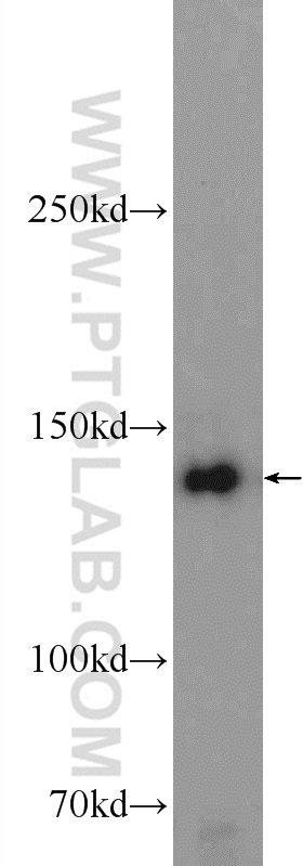 11462-1-AP;HEK-293 cells