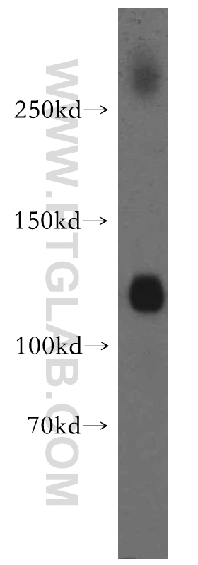 19565-1-AP;human brain tissue