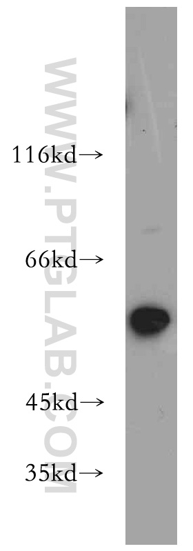 20676-1-AP;mouse heart tissue