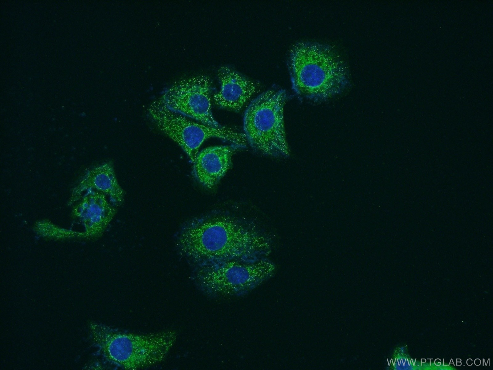 14160-1-AP;SH-SY5Y cells