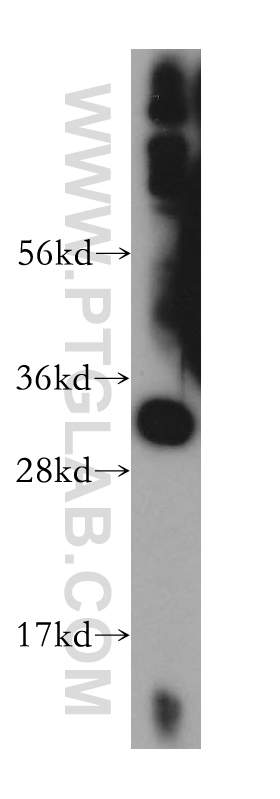 14160-1-AP;mouse skeletal muscle tissue