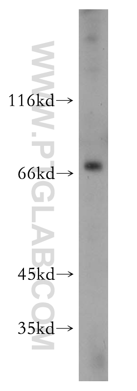 14048-1-AP;HepG2 cell