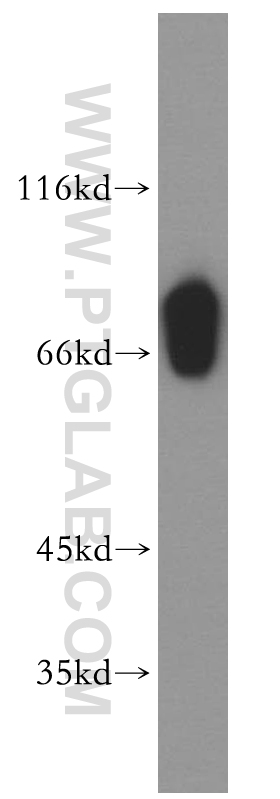 12943-1-AP;human testis tissue