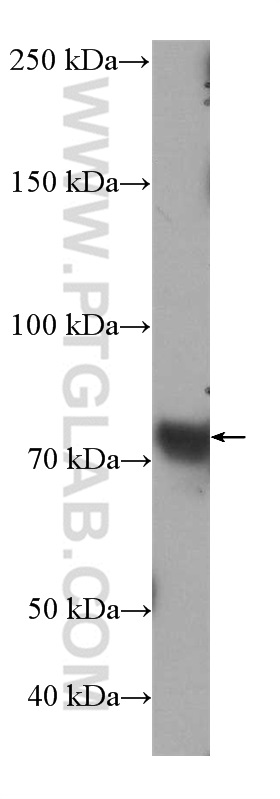 21295-1-AP;HEK-293 cells