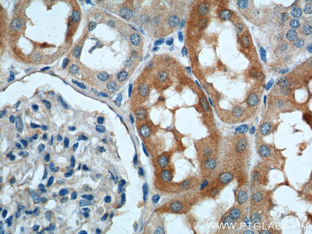 21517-1-AP;human kidney tissue