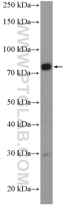 14089-1-AP;COLO 320 cells