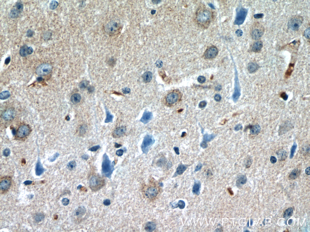 22524-1-AP;mouse brain tissue