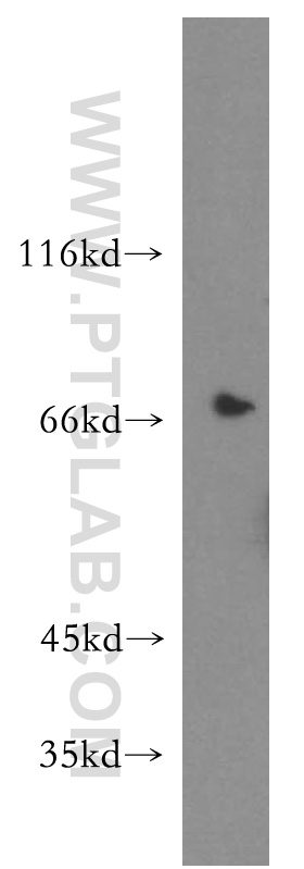 13718-1-AP;HepG2 cells