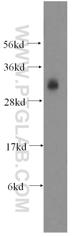 13315-1-AP;mouse testis tissue