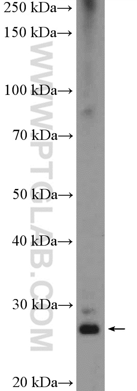 26183-1-AP;HeLa cells