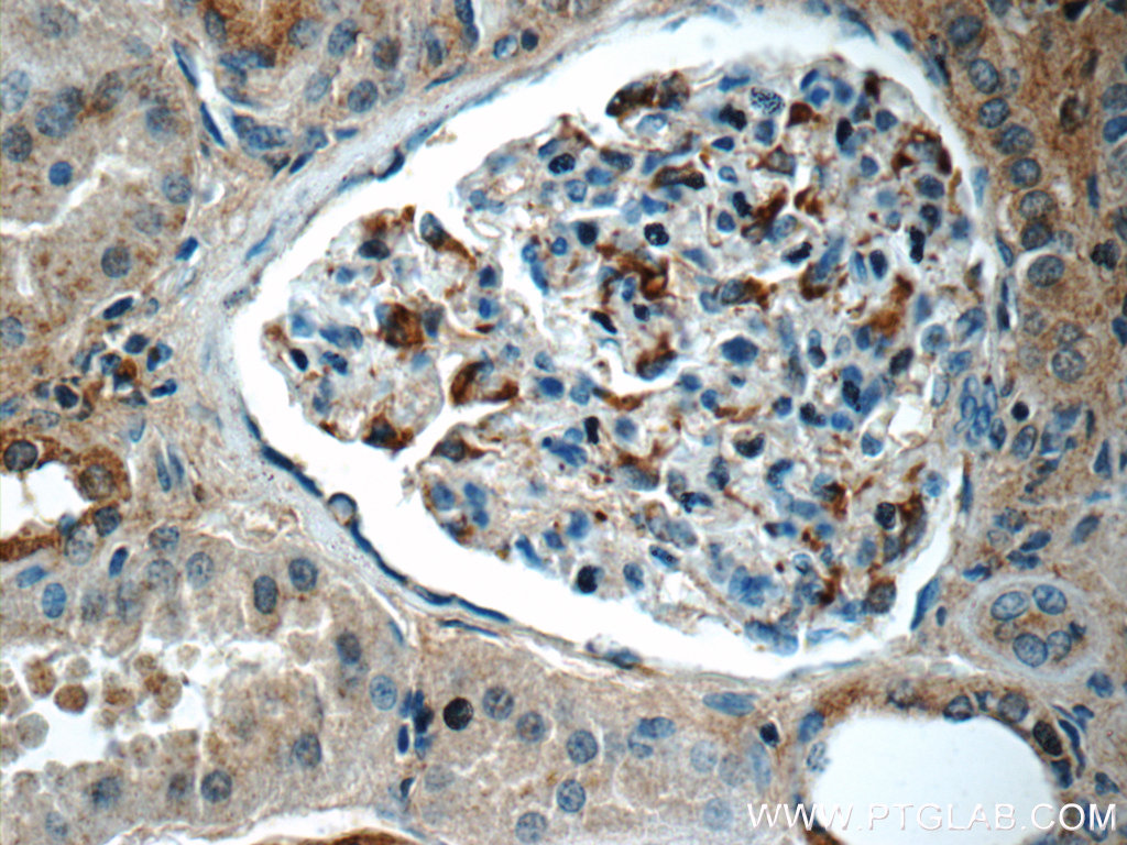 17818-1-AP;human kidney tissue