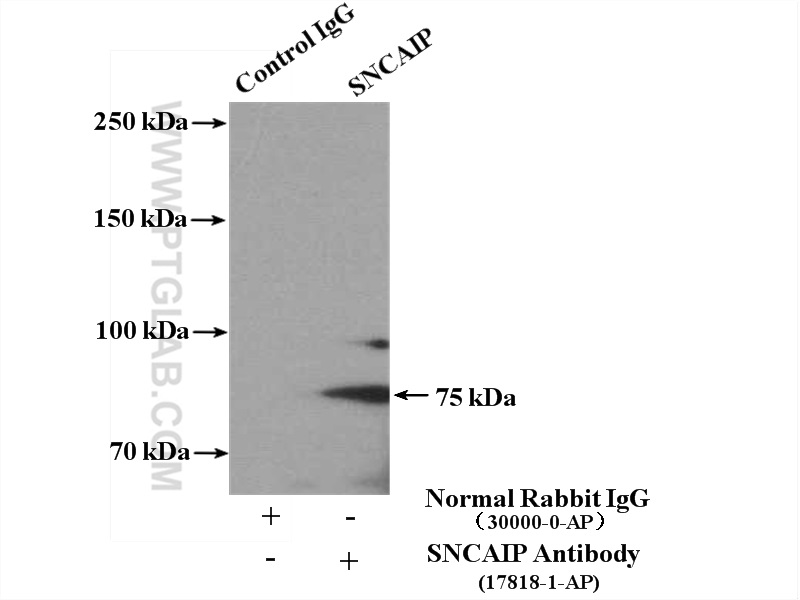 17818-1-AP;mouse brain tissue