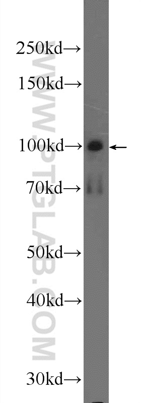 17818-1-AP;mouse brain tissue