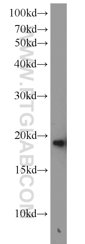 10498-1-AP;mouse brain tissue