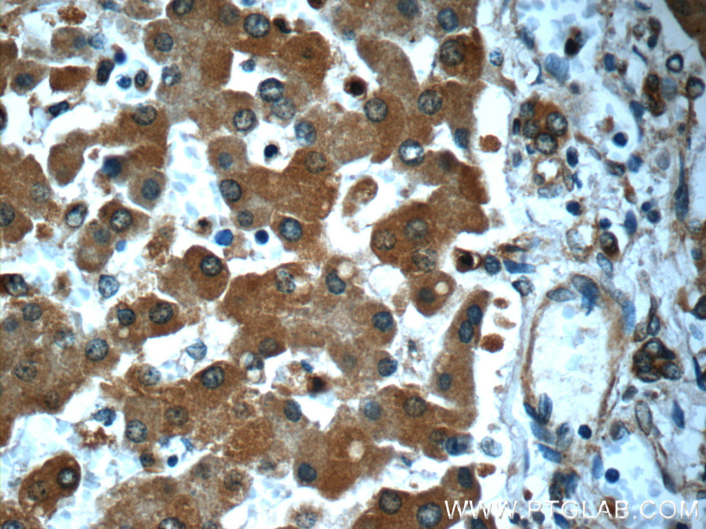 10760-1-AP;human liver tissue