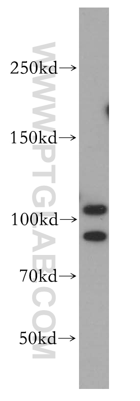 10760-1-AP;HeLa cells