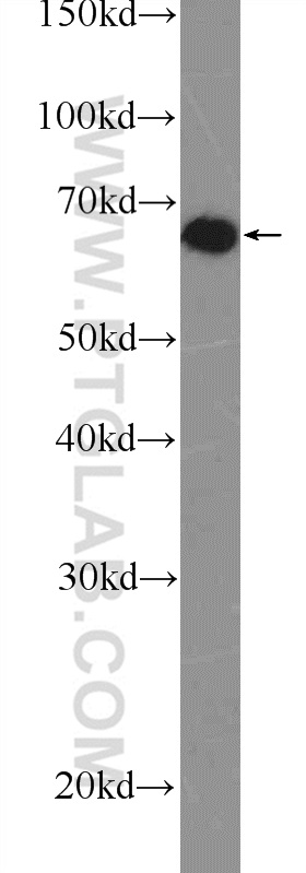 25926-1-AP;MCF-7 cells