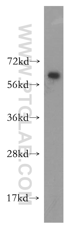 12783-1-AP;BxPC-3 cell