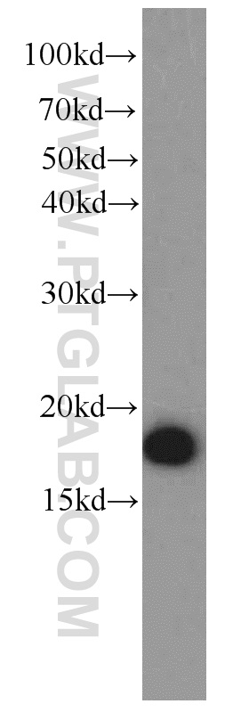 10269-1-AP;HEK-293 cell