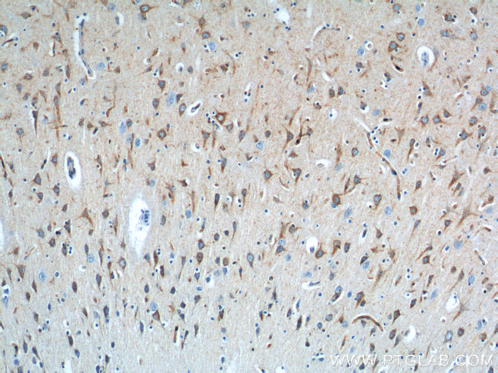 12369-1-AP;human brain tissue