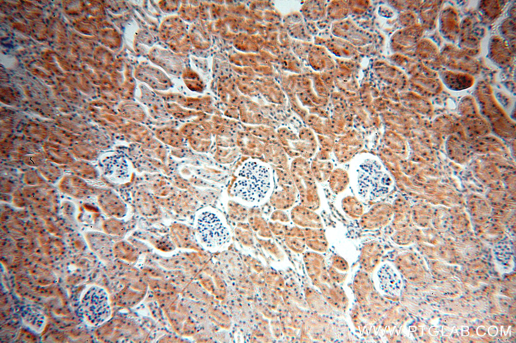 18902-1-AP;H-kidney