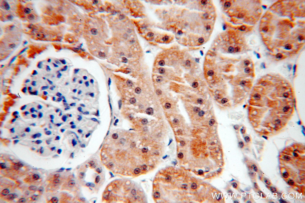 18902-1-AP;H-kidney