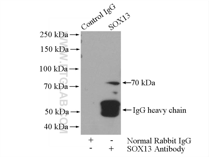 18902-1-AP;SH-SY5Y cells