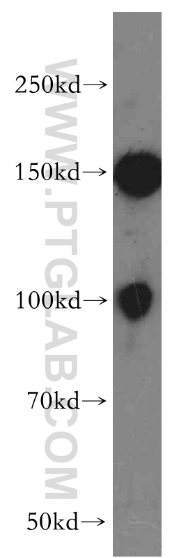 18902-1-AP;Jurkat cell