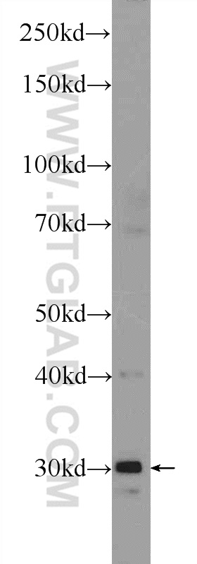 25415-1-AP;mouse skeletal muscle tissue