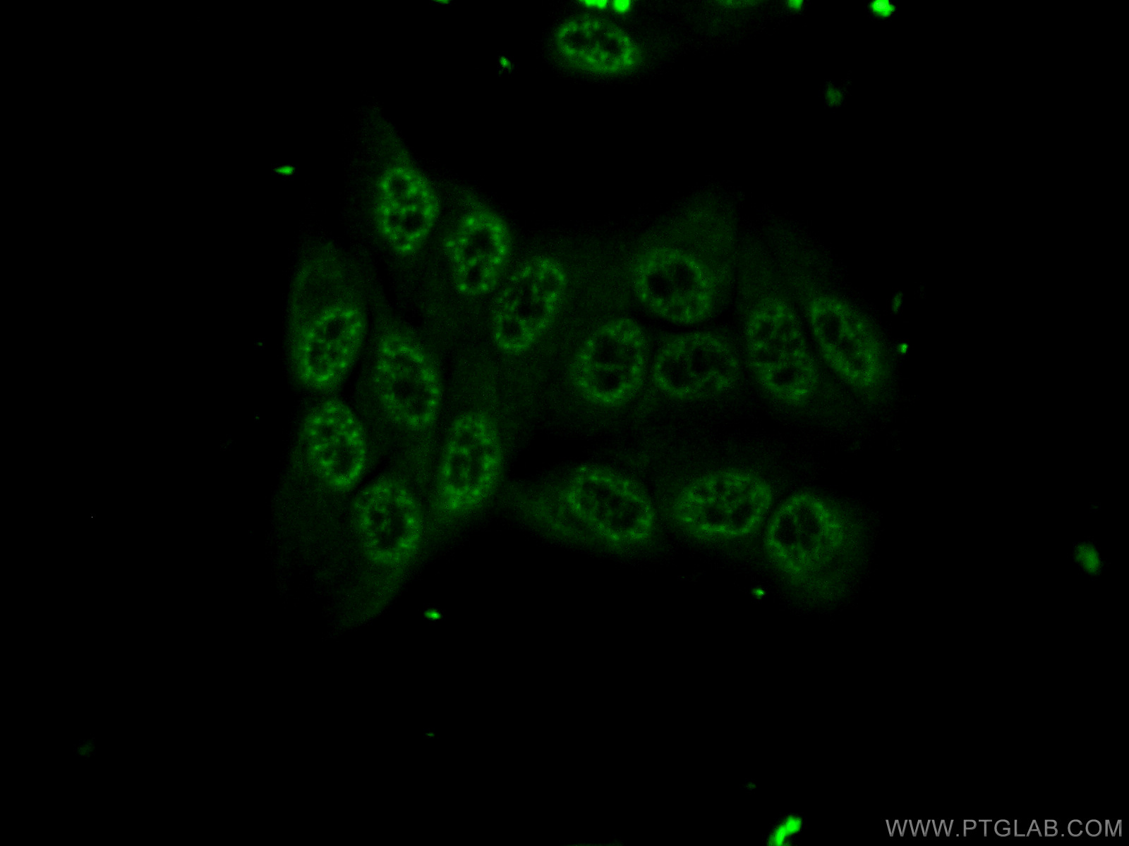 55100-1-AP;HepG2 cells