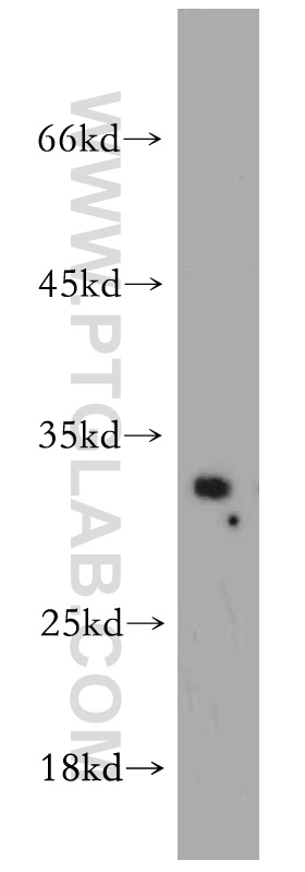 55100-1-AP;mouse liver tissue