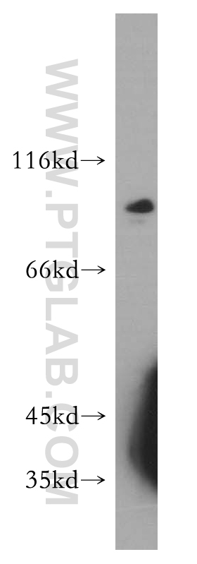 17757-1-AP;mouse cerebellum tissue